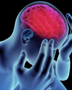 Columbia Brain Injury Lawyer