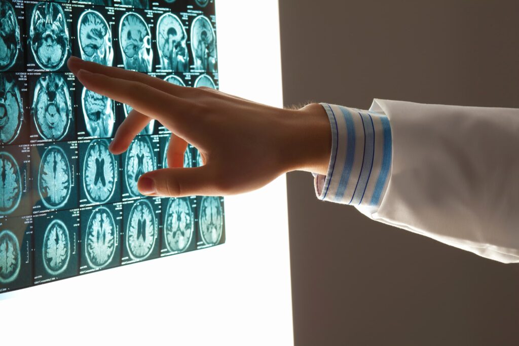 brain injury lawyer in Sumter, SC